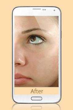 Photo Editor Blemish screenshot 4