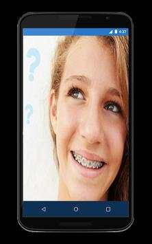 Braces Teeth Camera 2 تصوير الشاشة