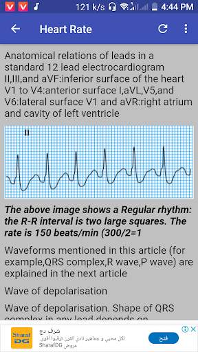 Clinical ECG Guide. screenshot 6