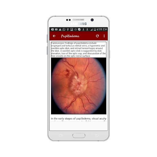 Ophthalmology Guide screenshot 3