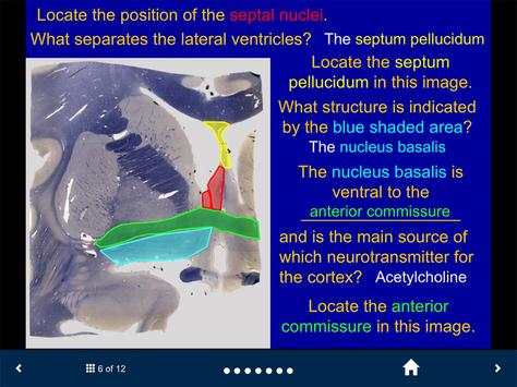Neuroanatomy Lite - SecondLook screenshot 3