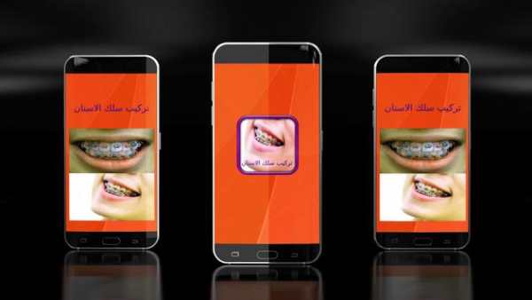 تركيب الاسنان - تقويم الأسنان 1 تصوير الشاشة