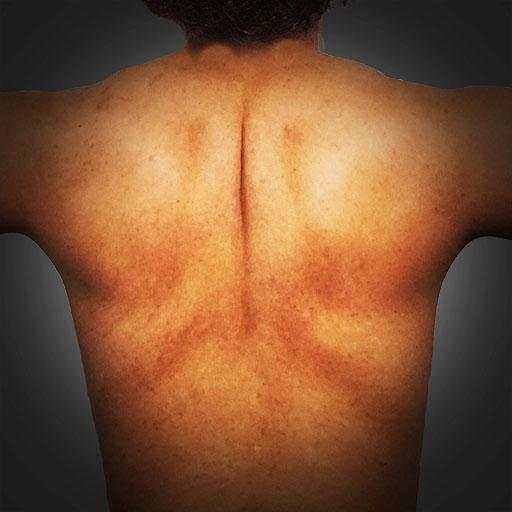 Scratch My Itchy Back 2.3