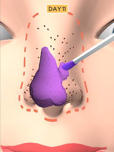 Nose Clean screenshot 10