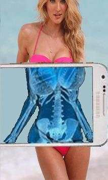 Xray Scanner screenshot 1