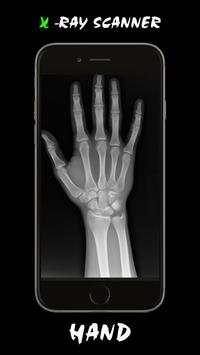 X - Ray Scanner screenshot 6