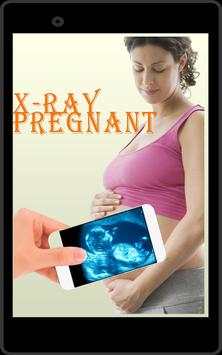X-Ray Pregnant simulated screenshot 1