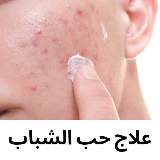 حب الشباب وعلاجه 1.0