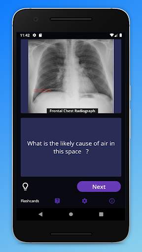 Basic Radiology for medical students screenshot 2
