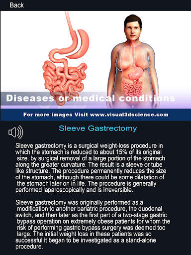 My Stomach Anatomy screenshot 13