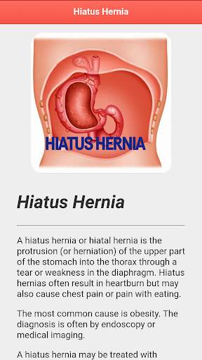Hiatus Hernia Disease screenshot 4