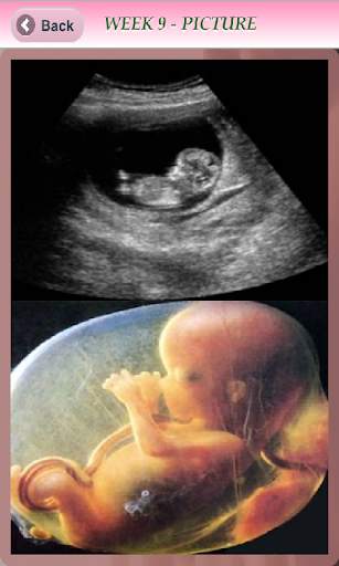 Pregnancy Info - Free screenshot 2