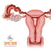 Mini Atlas Gynaecology 1.0.8