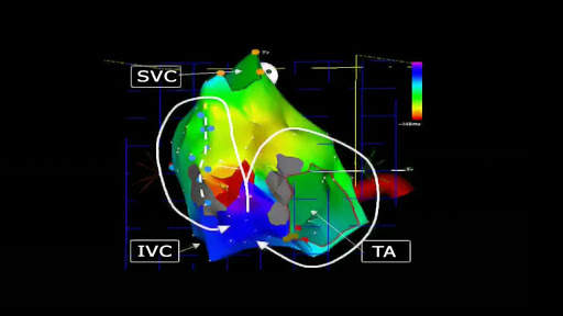 CARDIO3® EPA - Lite screenshot 4