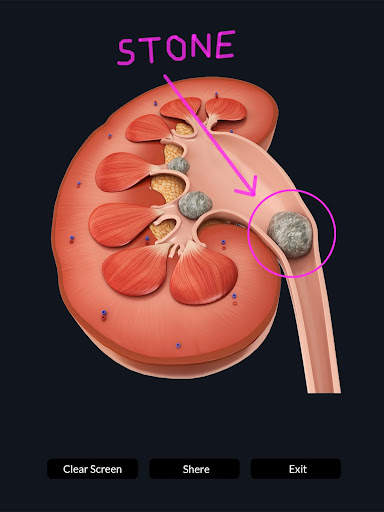 My Urinary System screenshot 7