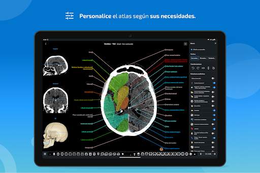 e-Anatomy screenshot 14