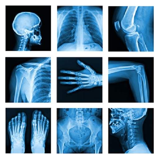 Medical X-Ray Interpretation w 4.0.2