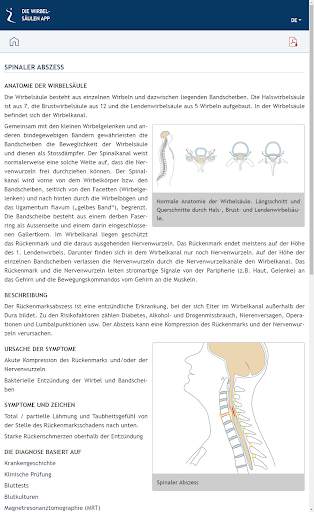 DIE WIRBELSÄULEN APP screenshot 8