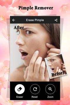 Pimple Remover : Beauty Plus screenshot 2