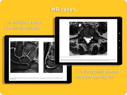 MRI Essentials screenshot 12