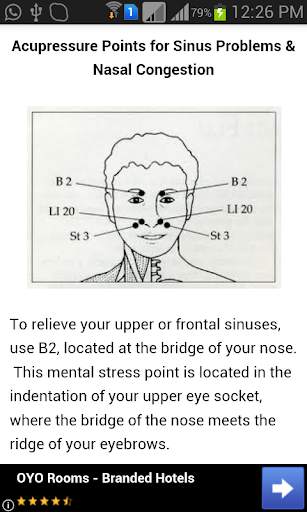 Acupressure Points Guide 2 تصوير الشاشة