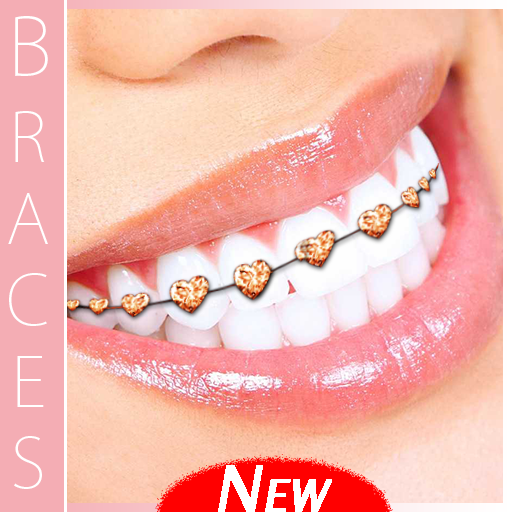 أقواس الاسنان - Teeth Braces أيقونة