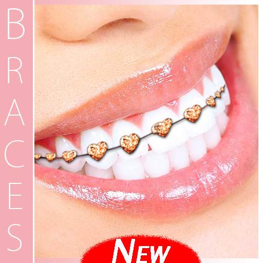 Braces Teeth Camera 4.0