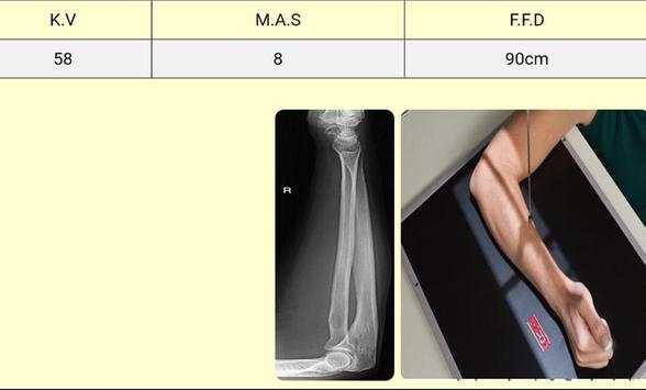 xray скриншот 6