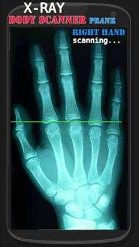 X-ray cloth Scanner Prank screenshot 1