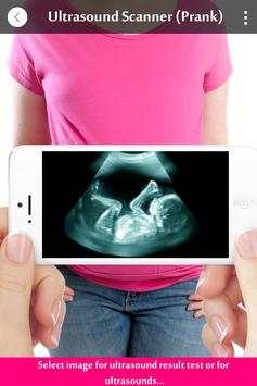 Ultrasound X-ray Scanner Prank screenshot 1