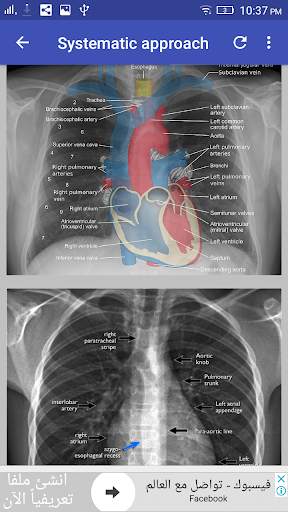 Chest X-Ray Interpretation screenshot 4