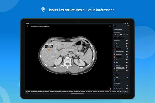 e-Anatomy screenshot 12