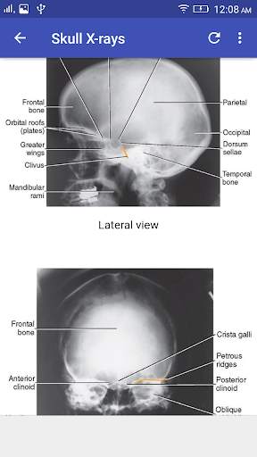 X-Ray Interpretation screenshot 2