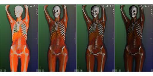 DroidRender - 3D DICOM viewer स्क्रीनशॉट 12