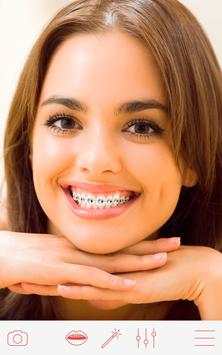 Braces screenshot 3