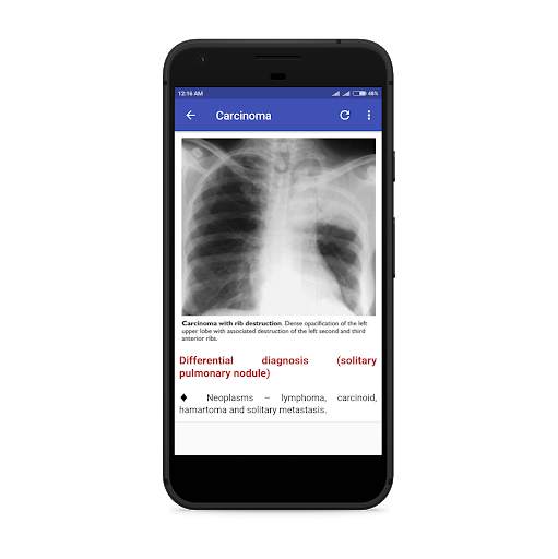 Chest Radiology 4 تصوير الشاشة