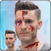 Injury Photo Editor-Fake Injury Photo Editor 2019 1.1