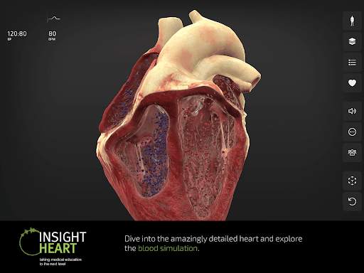 INSIGHT HEART Lite screenshot 10