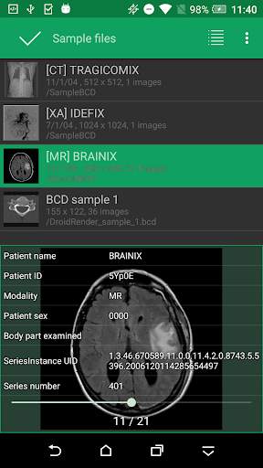 DroidRender - 3D DICOM viewer स्क्रीनशॉट 4