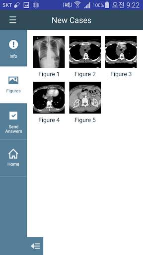 KSTR Weekly Chest Cases screenshot 4