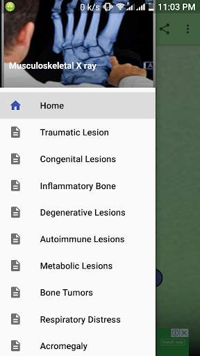 Bone X Ray Interpretation (Musculoskeletal X ray) screenshot 4