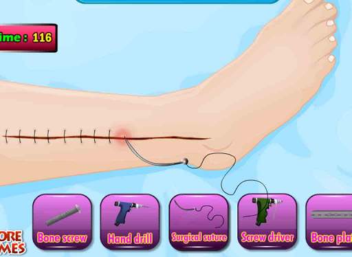 Doktor Tom Beinoperation Spiel screenshot 7