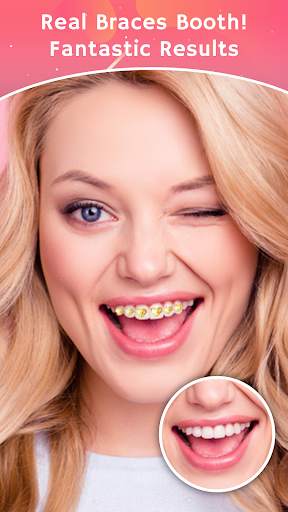 Teeth Braces Photo editor screenshot 1