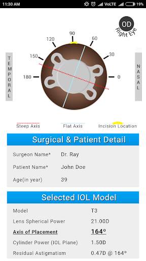 Axis Toric Calculator screenshot 6