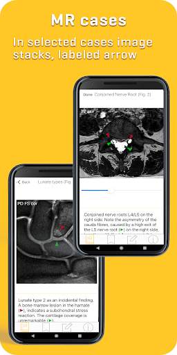 MRI Essentials screenshot 5