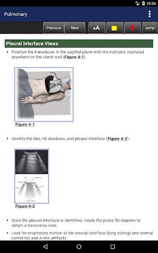 Pocket Atlas of Emergency Ultrasound, 2nd Edition screenshot 7
