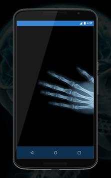 Xray Camera Scanner Prank screenshot 3