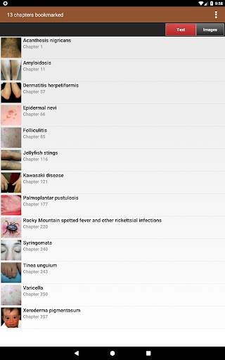 Lebwohl's Treatment of Skin Disease, 5th Edition screenshot 24