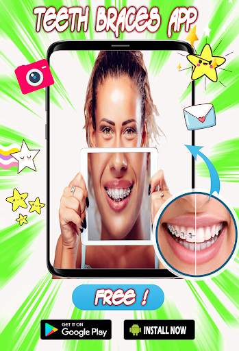 Braces Teeth  Photo Editor screenshot 4