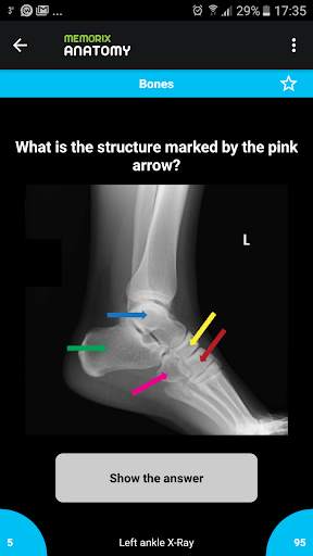 Memorix Anatomy QUIZ screenshot 3